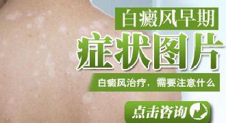 白癜风斑块首先从哪里开始