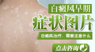 2岁儿童脸上的白斑怎么办