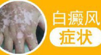 患有白癜风的症状
