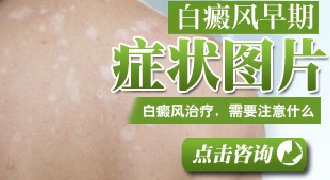 白癜风费用多少钱